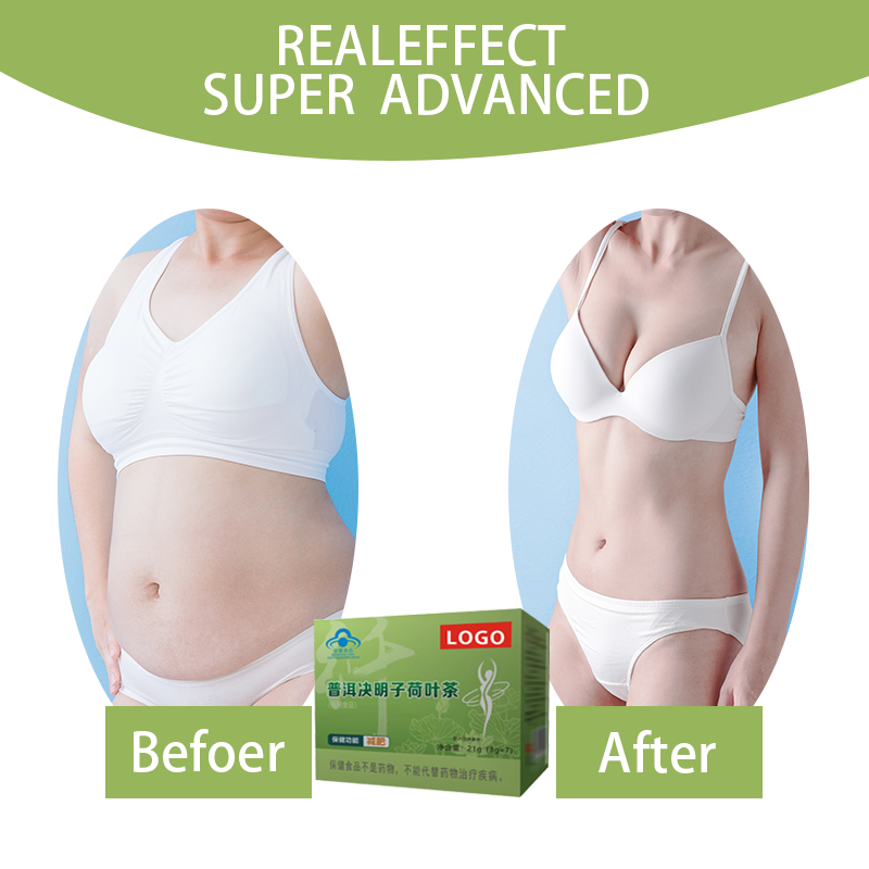 Wholesale Customized Fat Tummy Slimming Herbal Detox Tea Chinese Herbs Pu'er Cassia Seed Lotus Leaf Tea