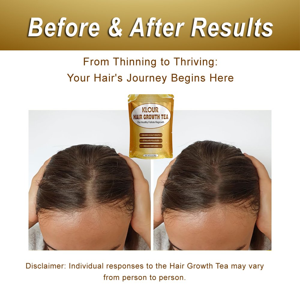 Private Label caffeine-free natural herbal tea for hair growth