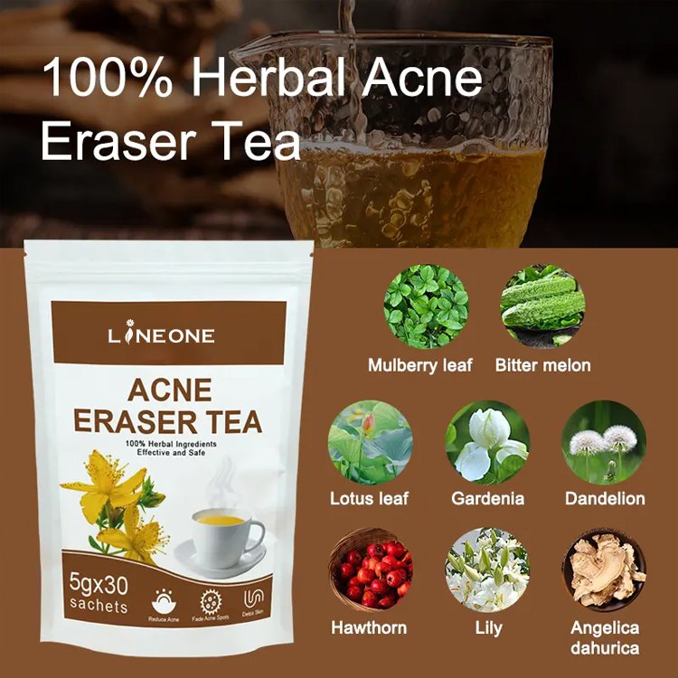 Best Acne Removal Tea Endocrine Conditioning Acne Detoxification Decrease Internal Heat Tea For Women And Men