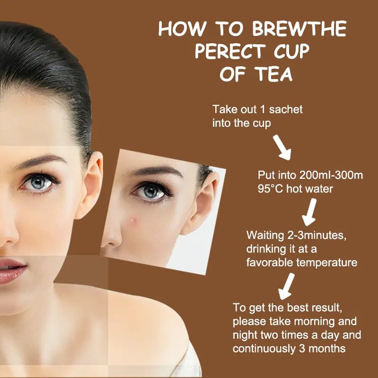 Best Acne Removal Tea Endocrine Conditioning Acne Detoxification Decrease Internal Heat Tea For Women And Men