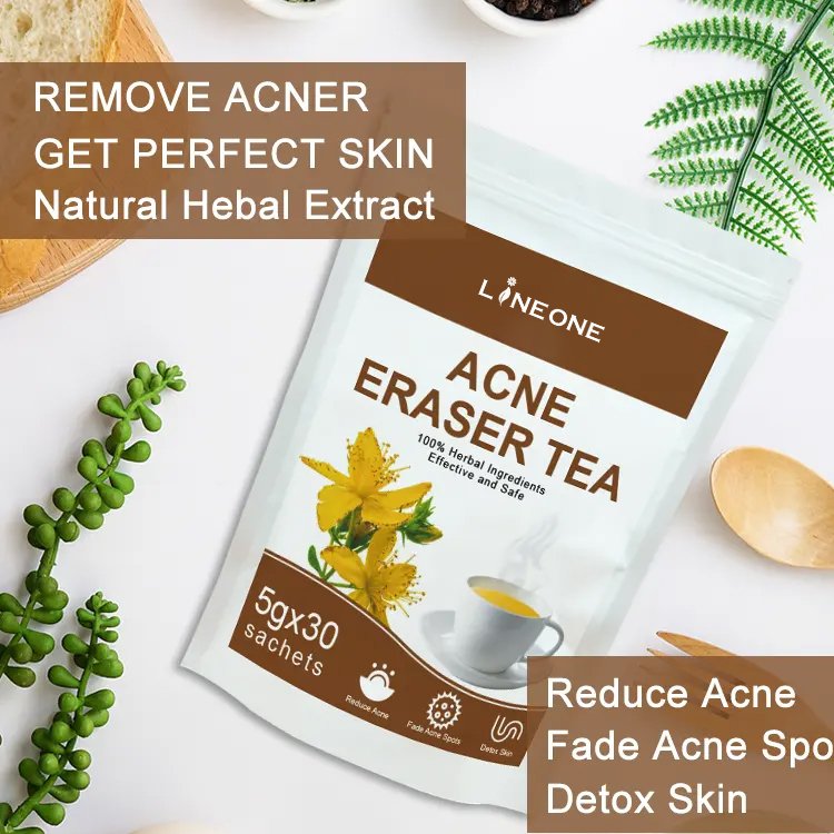 Best Acne Removal Tea Endocrine Conditioning Acne Detoxification Decrease Internal Heat Tea For Women And Men