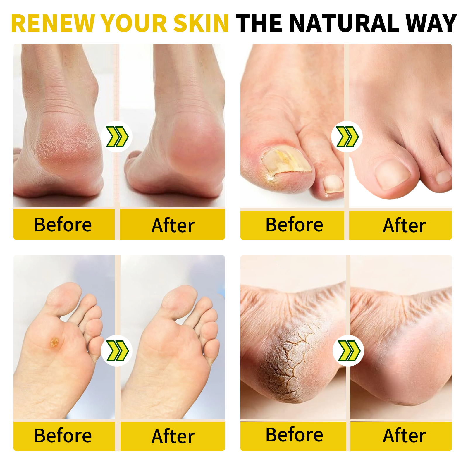 Wholesale Pedicure Detox Foot Soak Beads Pack Soothing Shaping Slimming Softhening Herbal Spa Bath Foot Soak