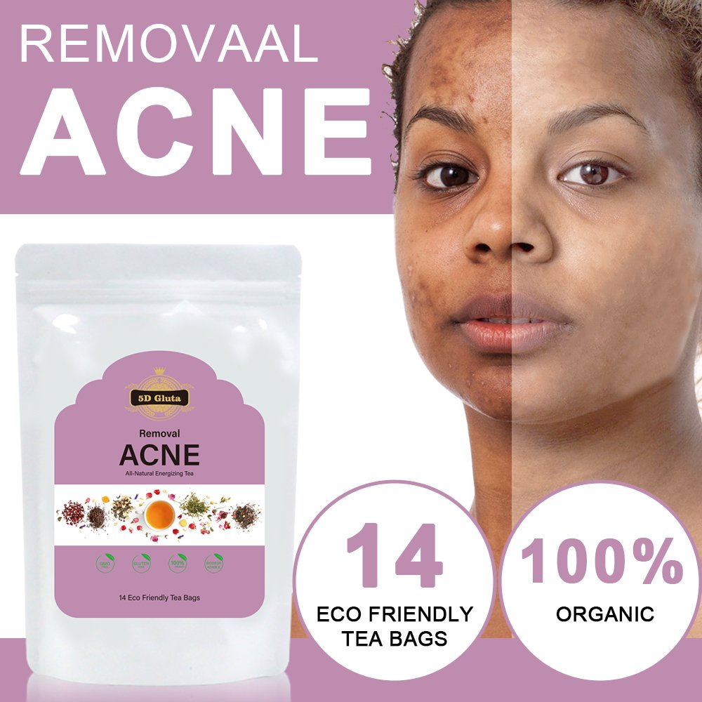 All-Natural EnergizingTea Bag Private Label Skin Whitening Beauty Removaal Detox Tea Herbal Tea For Women