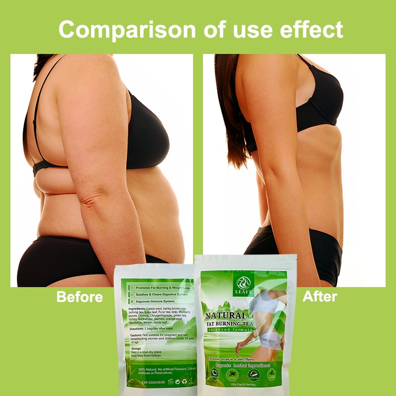 Wholesale Effective Natural Weight Loss Tea Fat Burning Slimming Organic Herb Tea Burn Fat Weight Loss Detox Slim Tea
