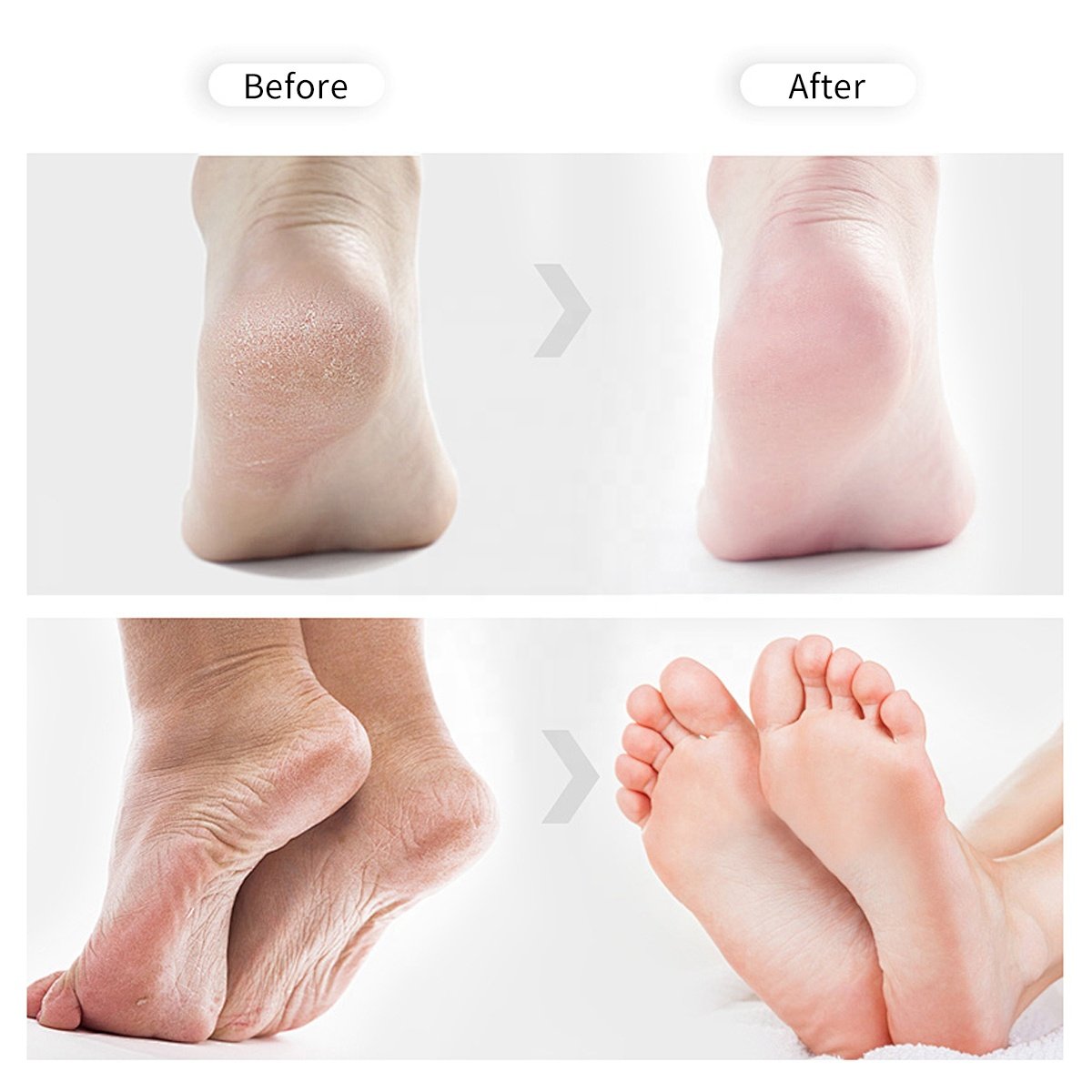 Private Brand Hyaluronic Acid Moisturizing Hand and Foot Cream Vitamin B Anti Drying and Anti Cracking Cream