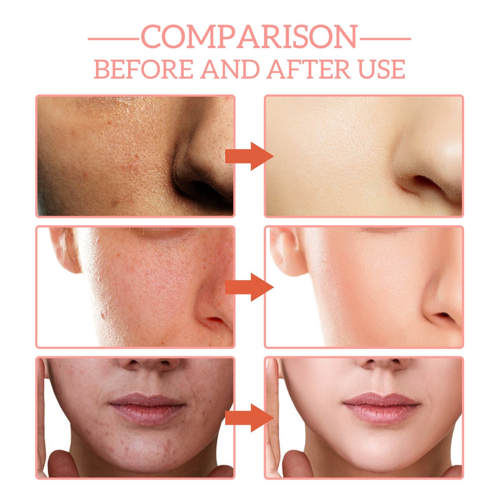 New Skin Care Serum Facial 5 in 1 Whitening Anti Age Face Serum with 30% Vitamin C 5% Niacinamide 10% Vitamin E Serum