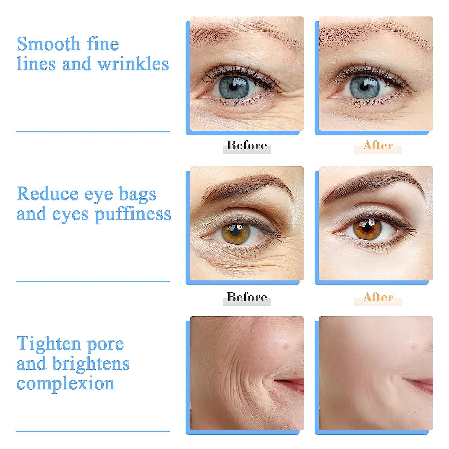 Daily Beauty Routines Unbreakable Anti Age Wrinkle Tighten Skincare Eyes Facial Masajeador Cryo Ice Roller Ice Globes for Face
