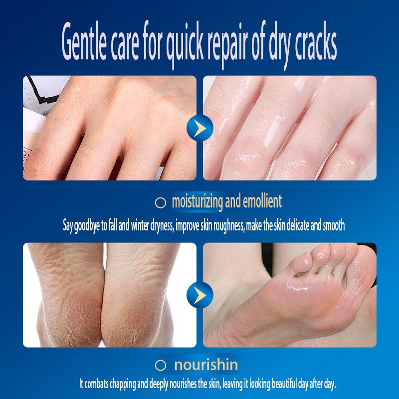 Customizable Frost Cream Frozen Crystal Texture Moisturizing Repair Nourishing Foot Hand Moisturizing Hydrating Repairing