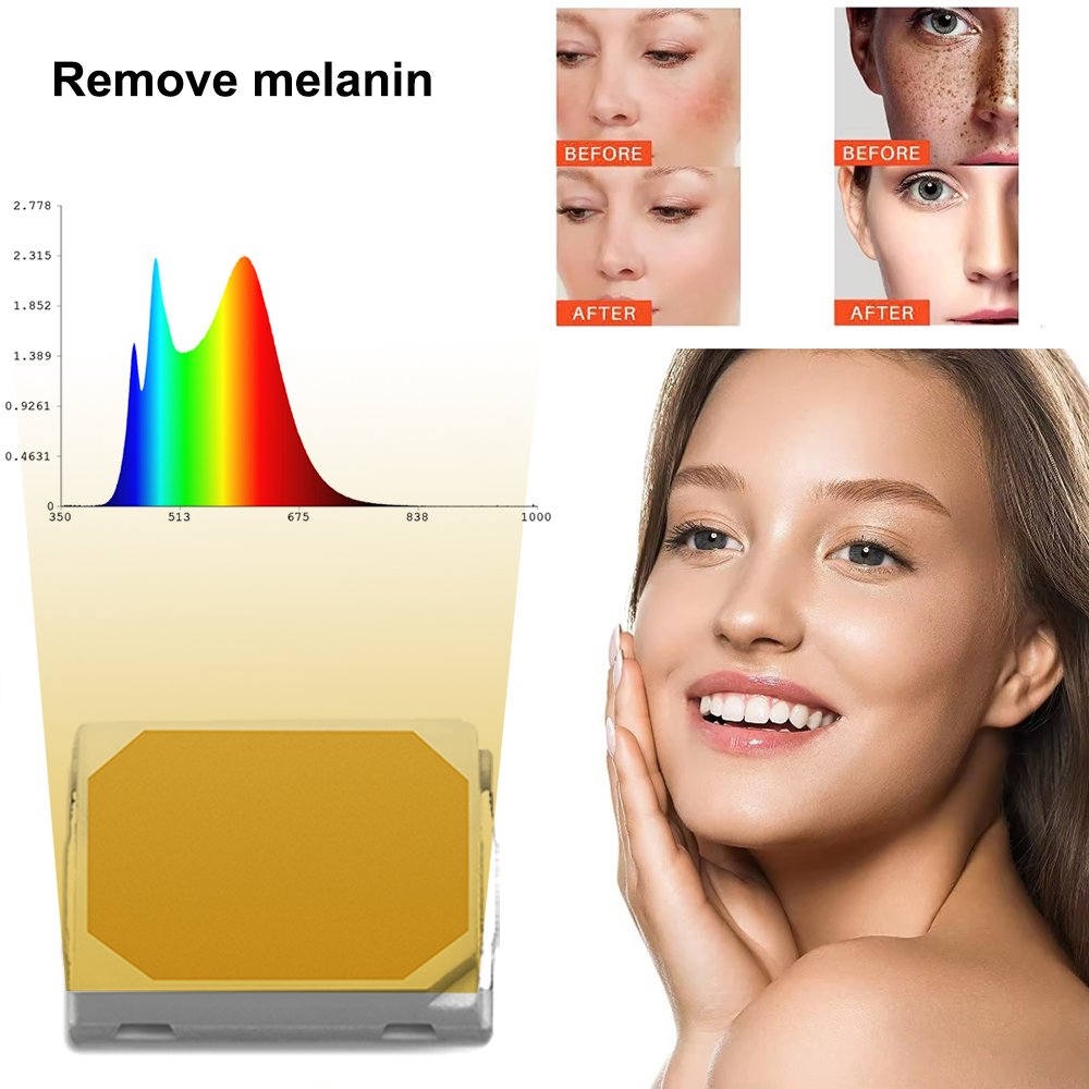 High Quality 3030 SMD LED 1W 6V 3800-4200K Free Sample for Remove Melanin and Pigmentation