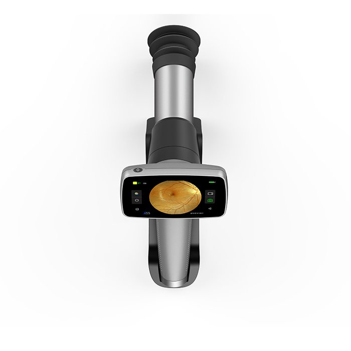 HFC-02 China Ophthalmic Portable Handheld Eye Fundus Retinal Camera with 16mp Image Resolution