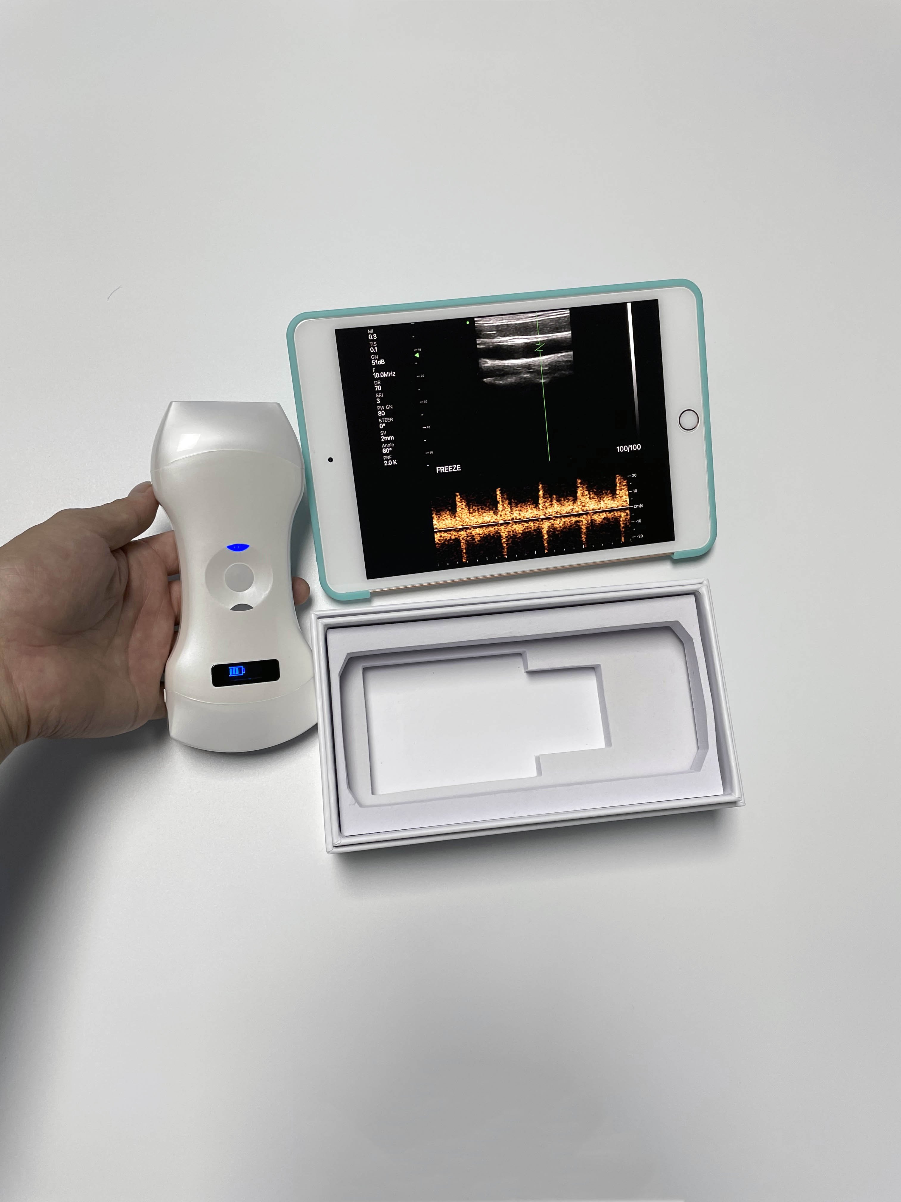 192 Element Phased Array Cardiac, Linear & Convex 3 in 1 Color Doppler Ultrasound Scanner Portable