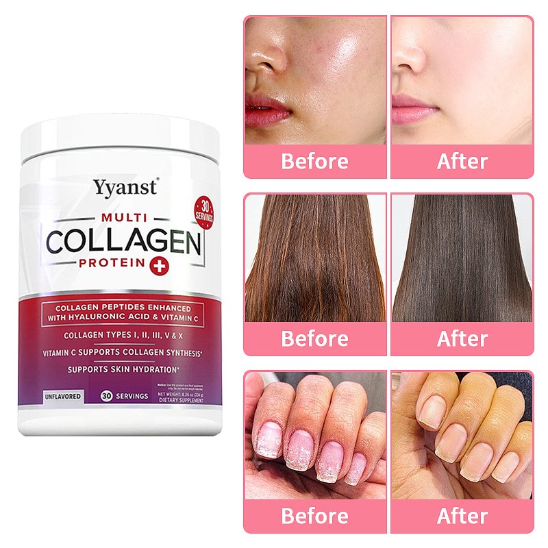 Multi Collagen Types I,II,III,V & X Protein Powder With Vitamin C Support Skin Hydration Promote Bone Healthy Collagen Drink