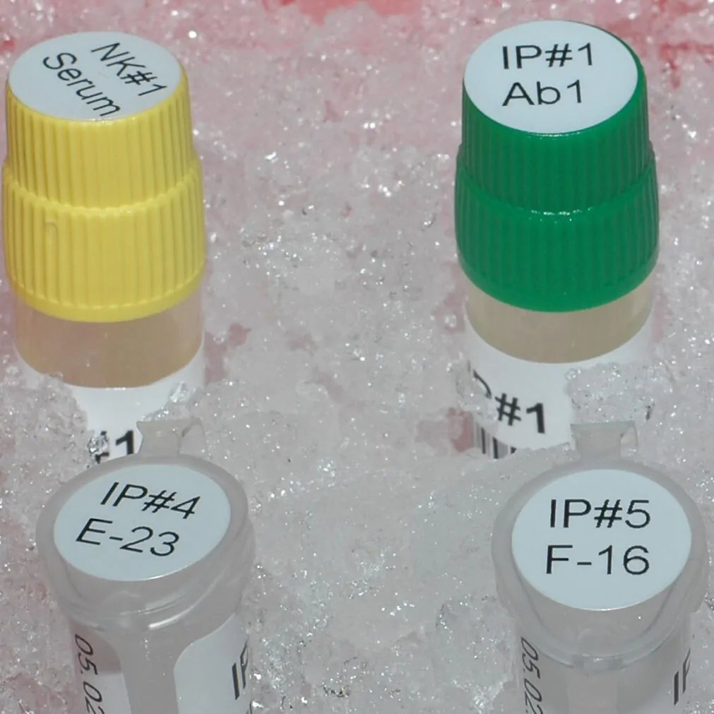 Low temperature resistant medical label sticker liquid nitrogen label sticker Test tube label