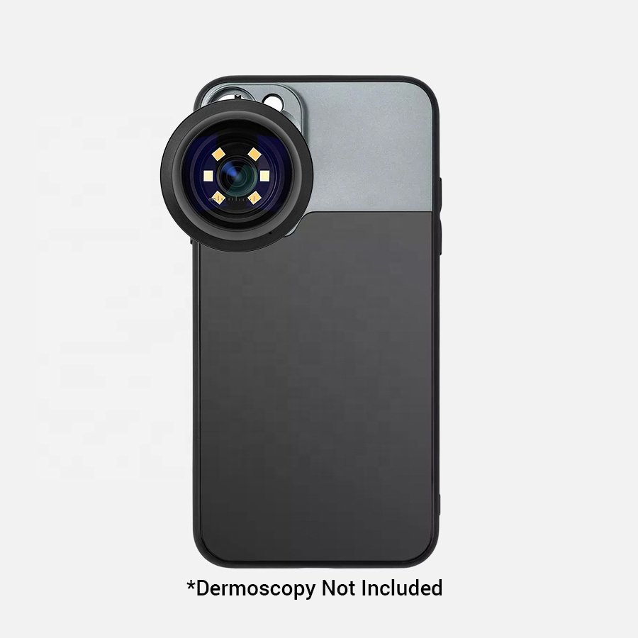 IBOOLO best supplier pc case dermatoscope adapter for iphone 15 pro max
