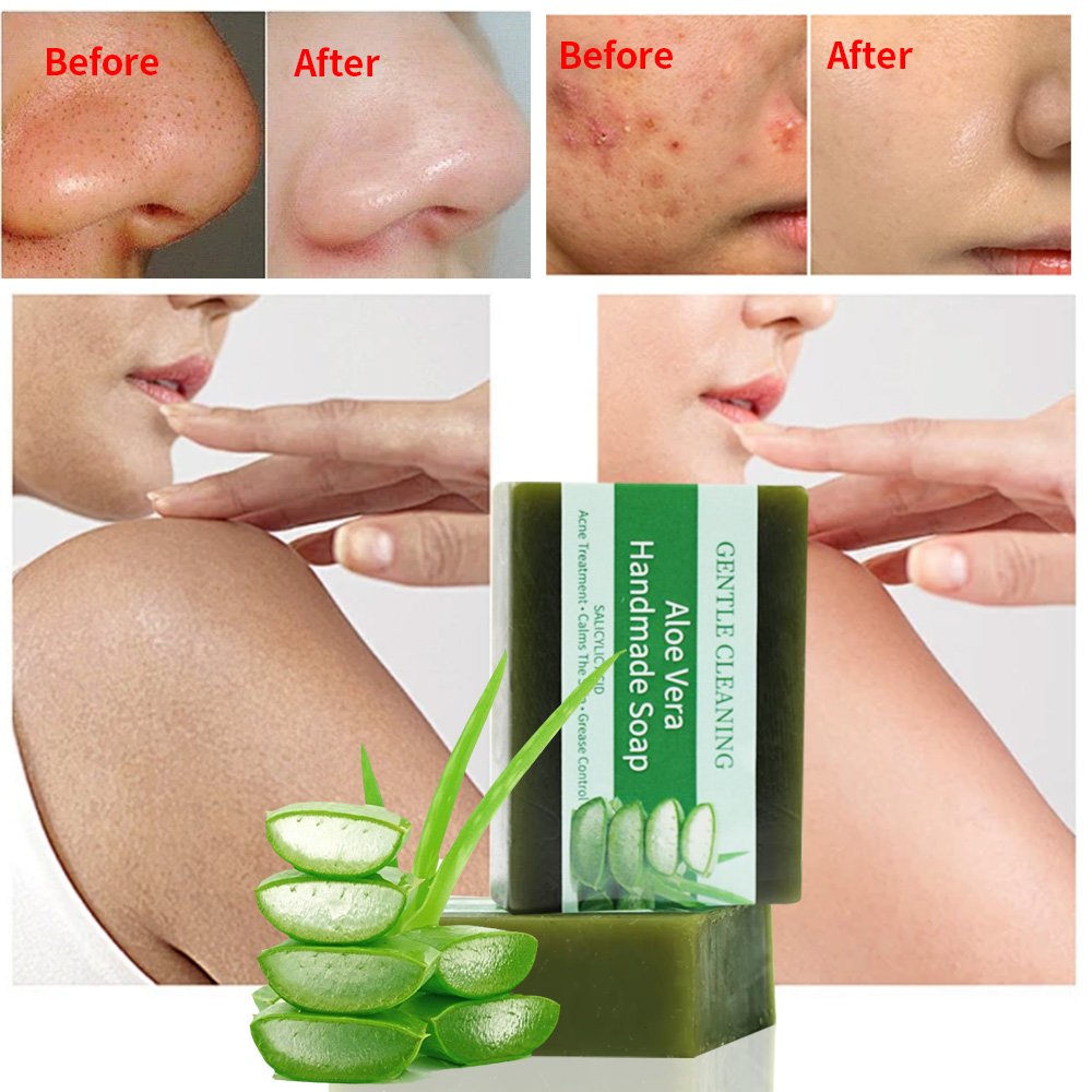 Private Label Natural Soap Beauty Products Aloe Vera Skin Whitening Soap Body Bathing Handmade Bathing Body Soap For Acne & Spa