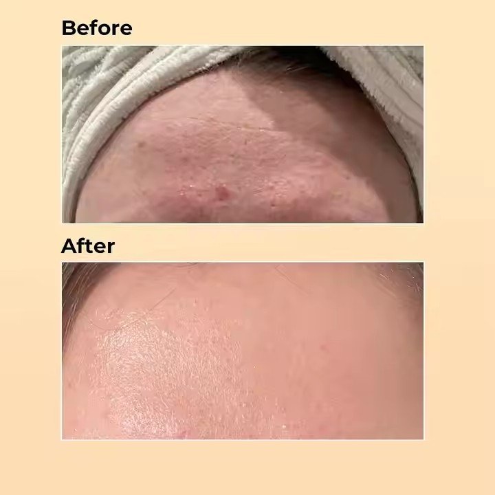 Herbicos Private label Beauty Skin Care Products anti aging brightening Advanced Snail korean skin care sets
