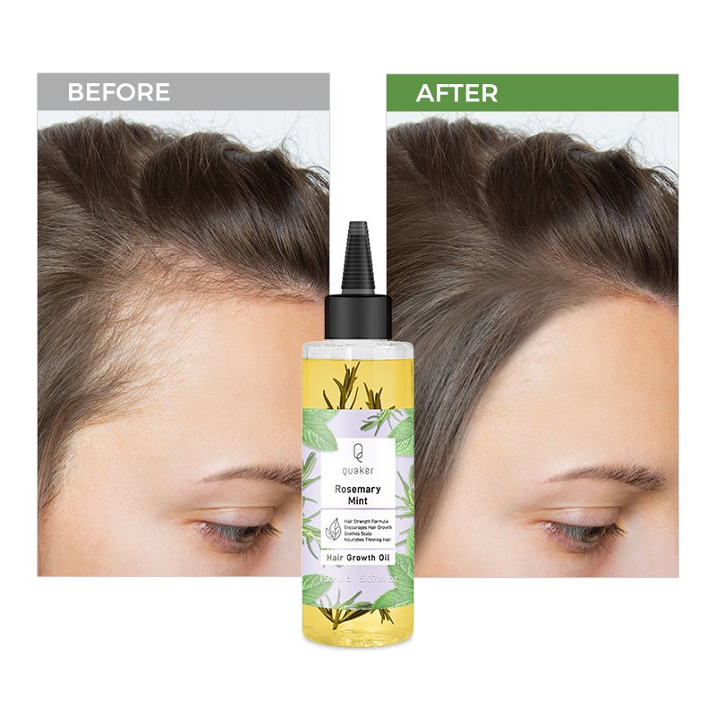 Qquaker Aceite Para El Crecimiento Del Cabello Hair Essential Oil Rosemary Oil Hair Growth Hair Growth Oil