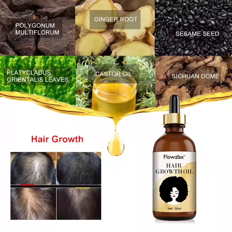 2025 Trending Hair Loss Treatment Wild Growth Hair Oil Rosemary Oil Hair Growth Serum Aceite Para El Crecimiento del cabello