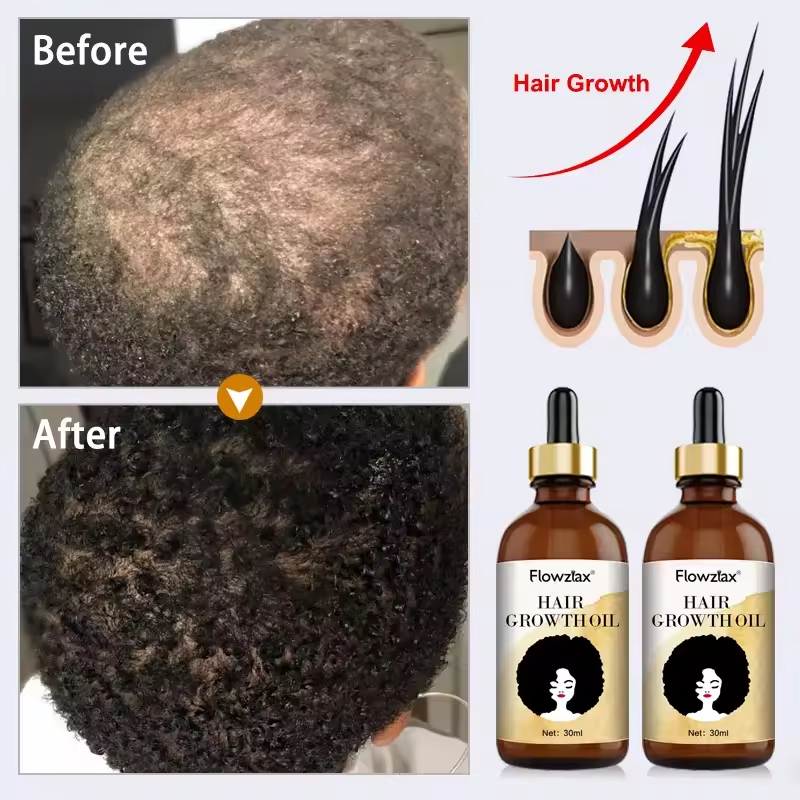 2025 Trending Hair Loss Treatment Wild Growth Hair Oil Rosemary Oil Hair Growth Serum Aceite Para El Crecimiento del cabello