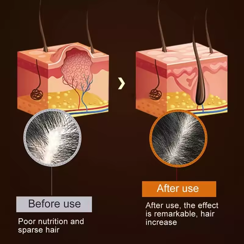 2025 Trending Hair Loss Treatment Wild Growth Hair Oil Rosemary Oil Hair Growth Serum Aceite Para El Crecimiento del cabello