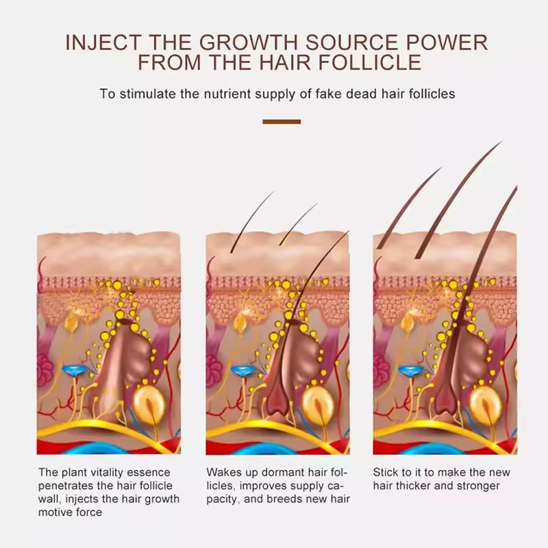 2025 Trending Hair Loss Treatment Wild Growth Hair Oil Rosemary Oil Hair Growth Serum Aceite Para El Crecimiento del cabello