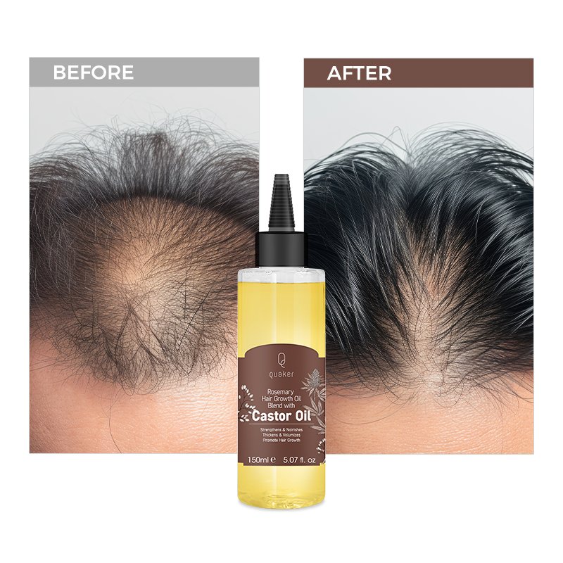 Qquaker Aceite De Romero Para El Crecimiento Del Cabello Castor Oil Hair Growth Oil For Men Organic Hair Oil