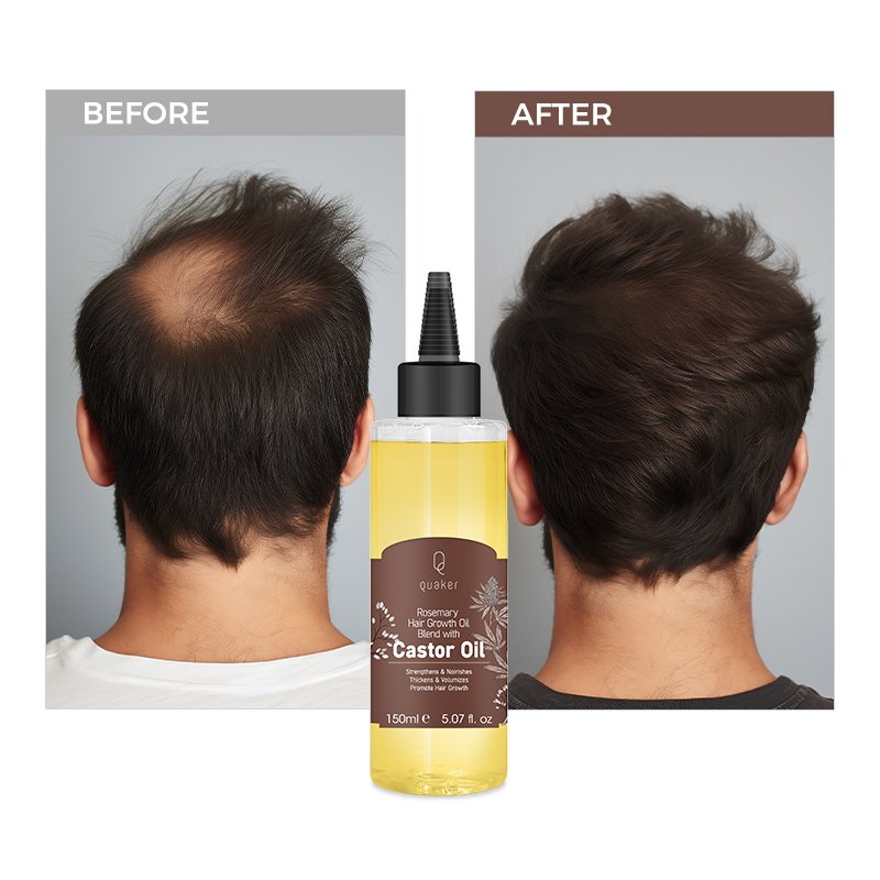 Qquaker Aceite De Romero Para El Crecimiento Del Cabello Castor Oil Hair Growth Oil For Men Organic Hair Oil