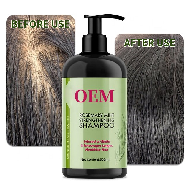 CHAMPU PARA EL CRECIMIENTO DEL CABELLO FOR WOMEN MEN ROSEMARY MINT STRENGTHENING HAIR REGROW SHAMPOO FOR THINNING HAIR