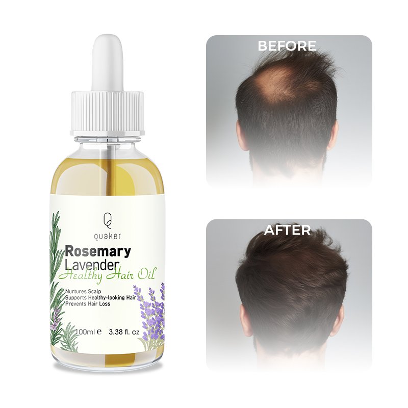 Qquaker Lavender Aceites Para El Cabello Wild Growth Hair Oil Batana Oil For Hair Growth