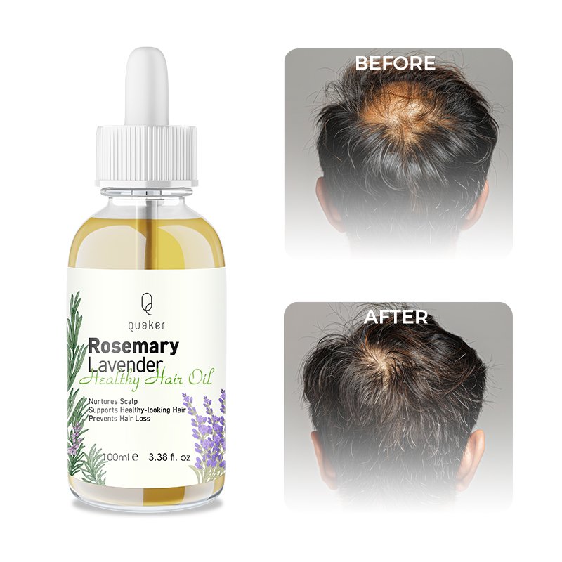 Qquaker Lavender Aceites Para El Cabello Wild Growth Hair Oil Batana Oil For Hair Growth
