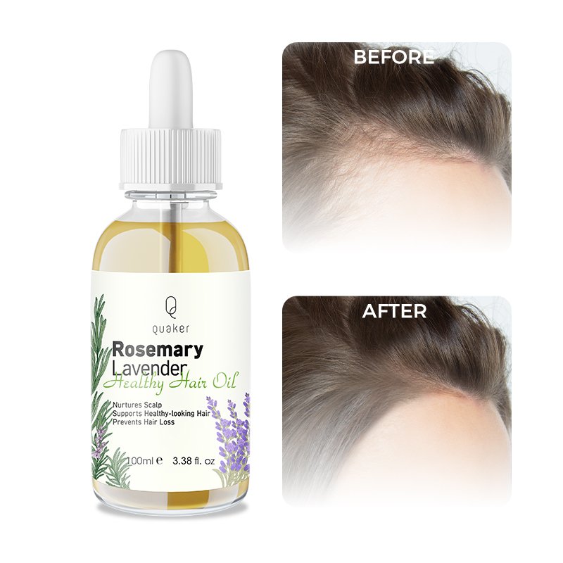 Qquaker Lavender Aceites Para El Cabello Wild Growth Hair Oil Batana Oil For Hair Growth