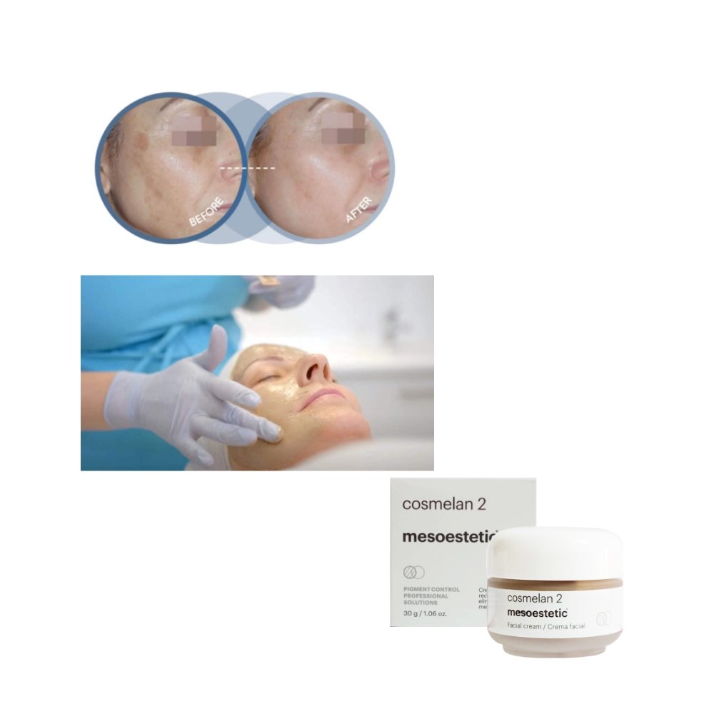 Hot sale Rejeon products cosmelan 2 mesoesthetic from Spain
