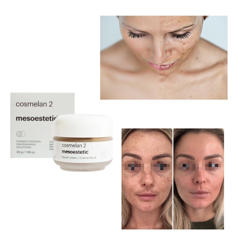 Hot sale Rejeon products cosmelan 2 mesoesthetic from Spain