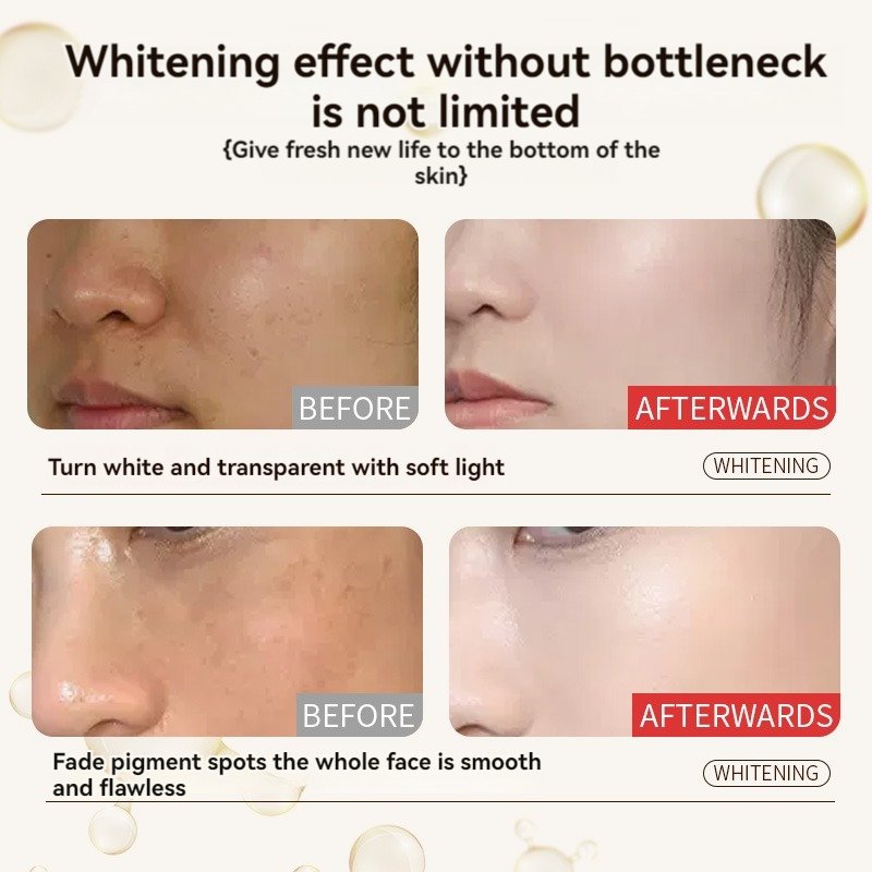 Personal Care Can Customize Facial Moisturizing Essence Moisturizing Whitening And Freckle Removing Essence