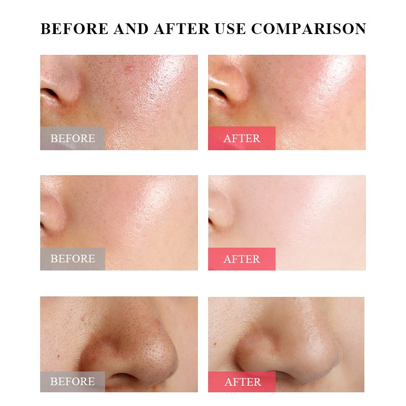 Private Label Skin Care Mascarilla de barro Blackhead Remover Oil Control Dead Sea Clay Face Mask Masque de boue For Face Care