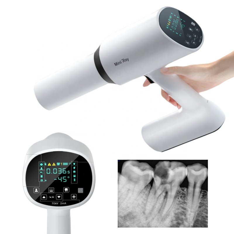 Original Ai Ray Mini Touch Screen Dental X Ray Camera Constant DC High Frequency X-Ray Machine Dental Imaging System