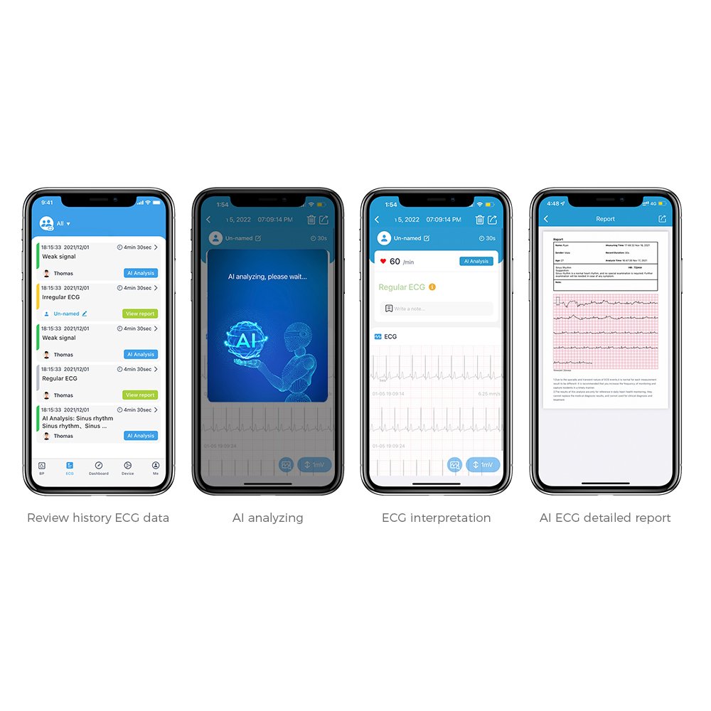 Viatom BP2 WIFI Bluetooth AI Analysis Automatic Upper Arm Tensimeter Digital ECG EKG Heart Bp Machine Blood Pressure Monitor
