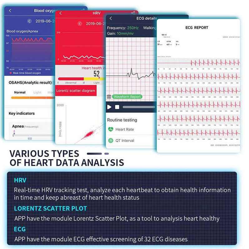 2022 Wearable ECG Monitor Best ECG PPG Smartwatch With Blood Pressure