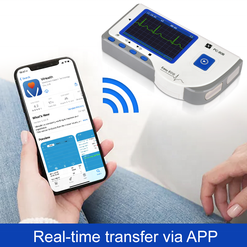 PC-80B Creative Bluetooth Heart Monitoring Electrocardiogram Portable Electrocardiograph Ecg Monitor Ekg Machine At Home