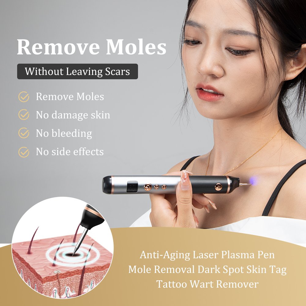 Trends Plasma pen Facial Tag Removal painless Plasma Pen Cauterizer Removing Electrocautery Wart Papilloma Skin Eraser Mole Pen