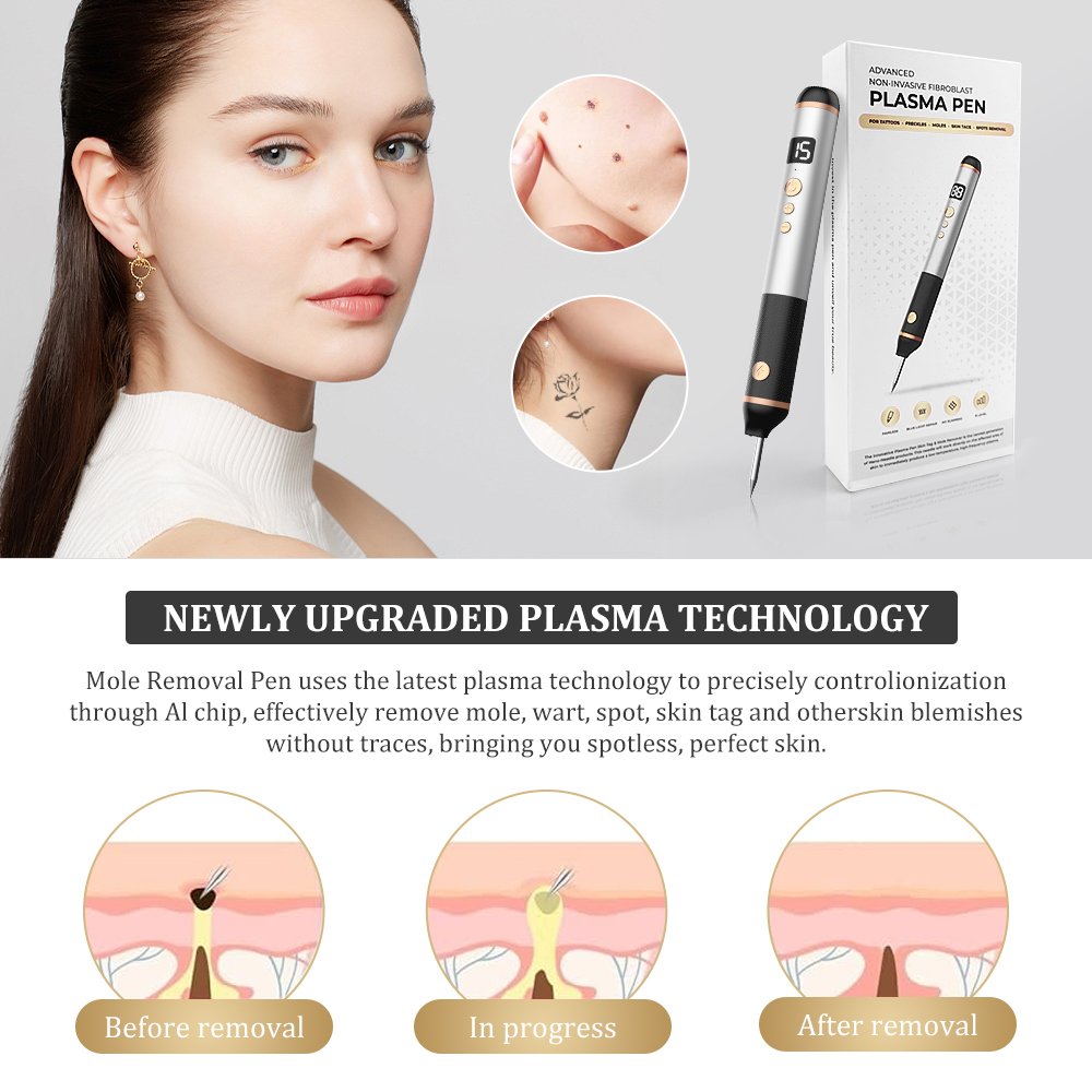 Trends Plasma pen Facial Tag Removal painless Plasma Pen Cauterizer Removing Electrocautery Wart Papilloma Skin Eraser Mole Pen