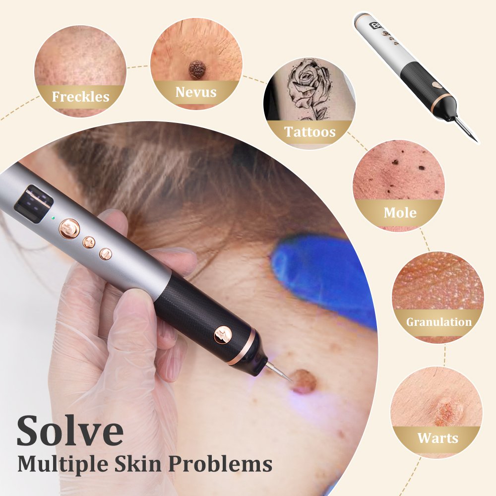 Trends Plasma pen Facial Tag Removal painless Plasma Pen Cauterizer Removing Electrocautery Wart Papilloma Skin Eraser Mole Pen