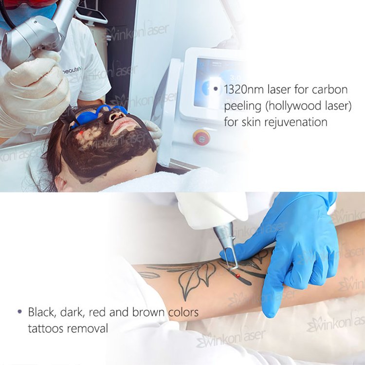 Picosecond 1064nm 755nm 532nm Pico q switched Nd Yag Laser Pico Laser Tattoo Removal Picosecond laser machine price