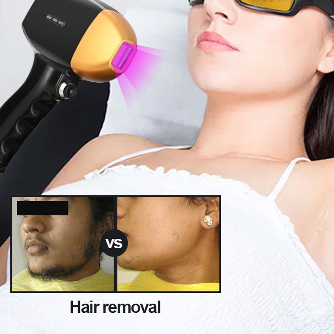 Titanium diode laser permanent hair removal beauty salon use laser beauty machine nd yag laser colorful tattoo removal machine