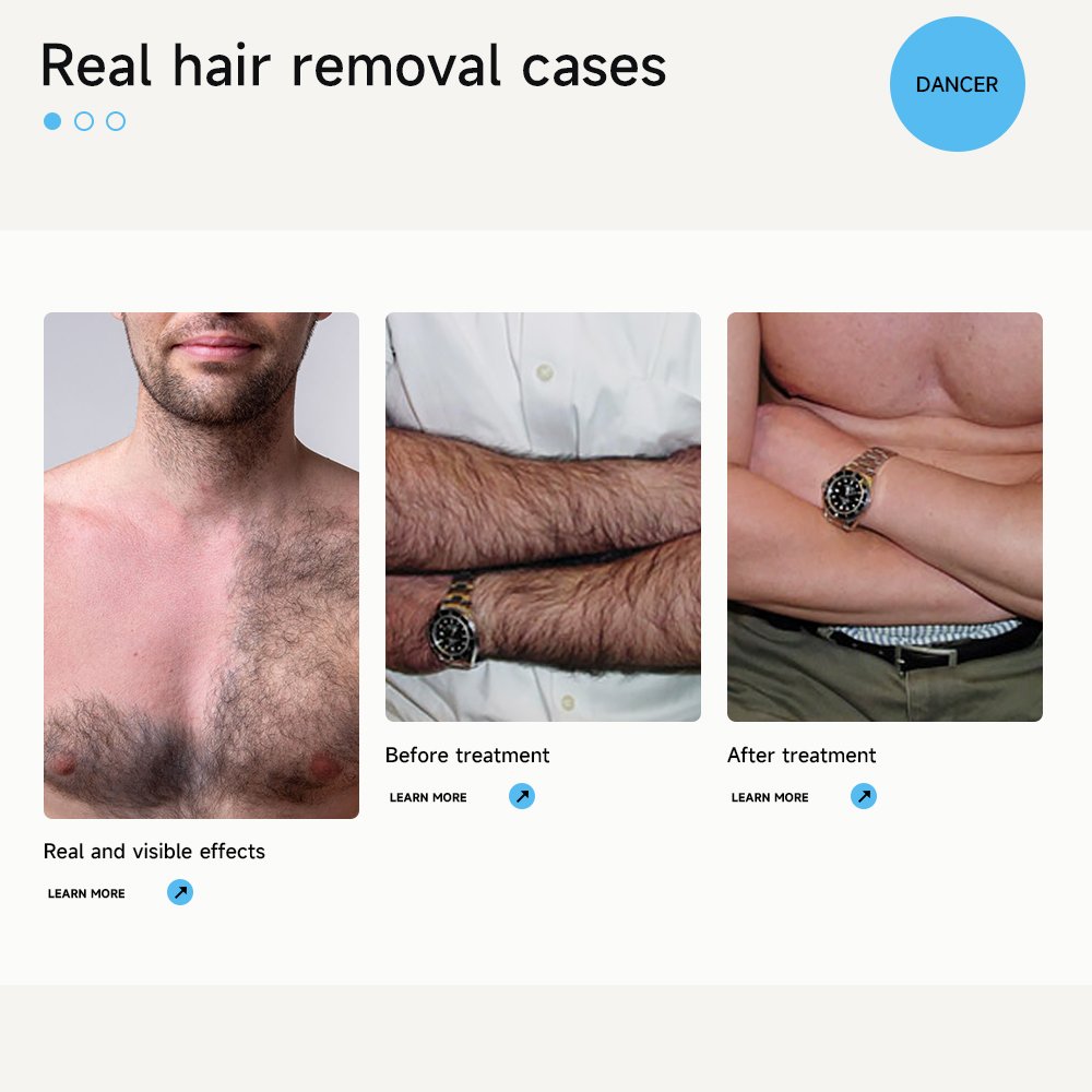 2024 latest 4K 1000W 1200W 1600W Triple wave 808nm laser diode hair removal/755 8081064 diode laser machine price
