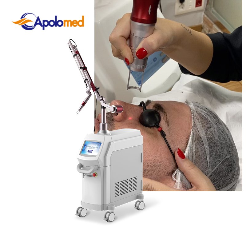 laser nd yag 2500w q switch nd yag laser 600w remove tattoo nd yag laser machine machine