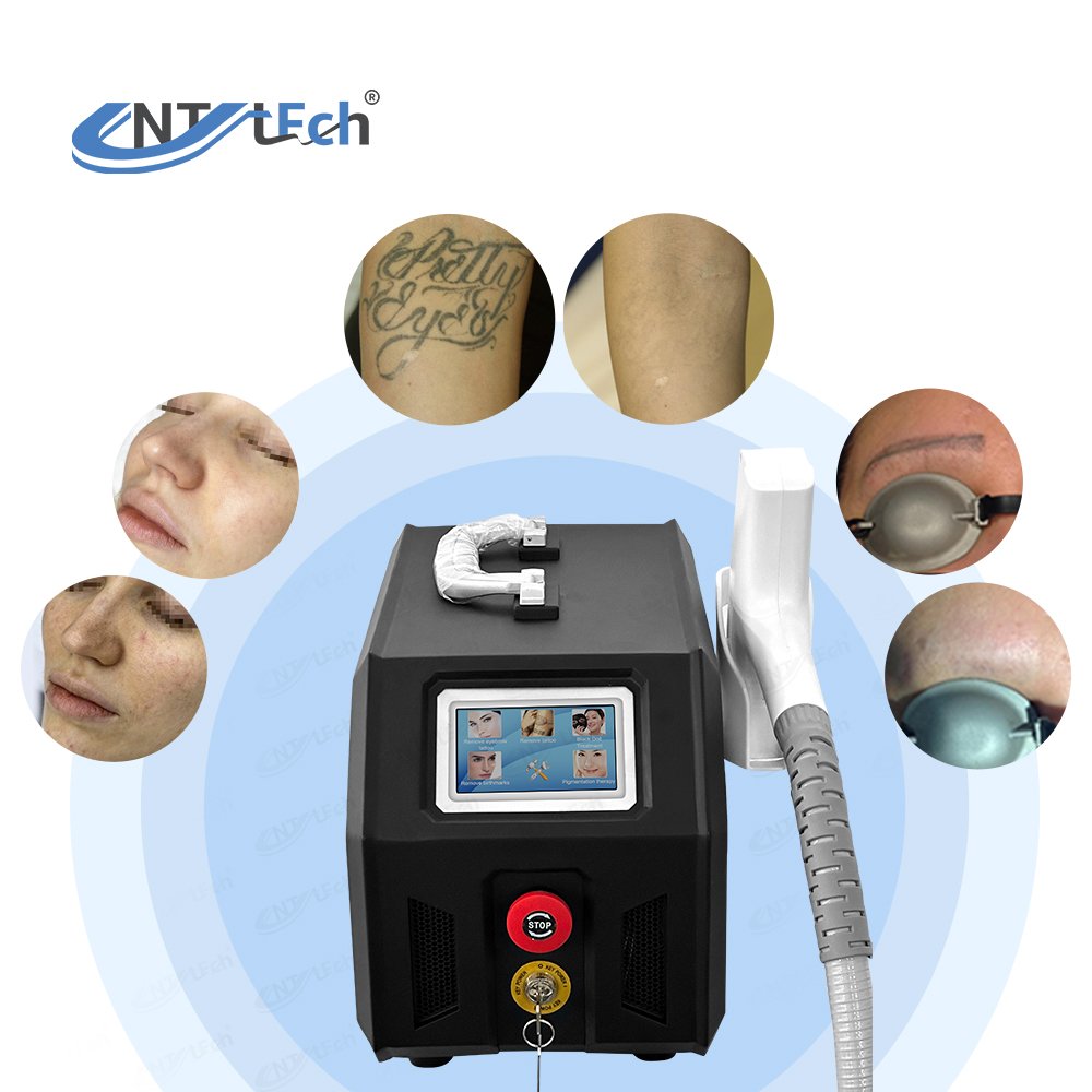 1064nm Nd yag Laser tattoo remove machine tattoos qswitch pico second laser tattoo removal picolaser