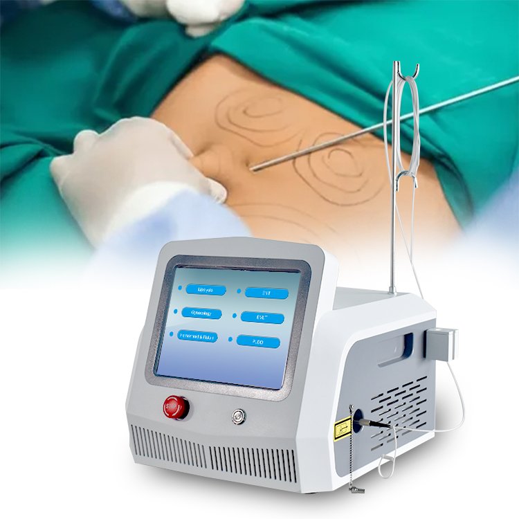 2023 newest diode lipo laser machine 980nm 1470nm diode laser liposuction /lipolisis slimming endolaser machine