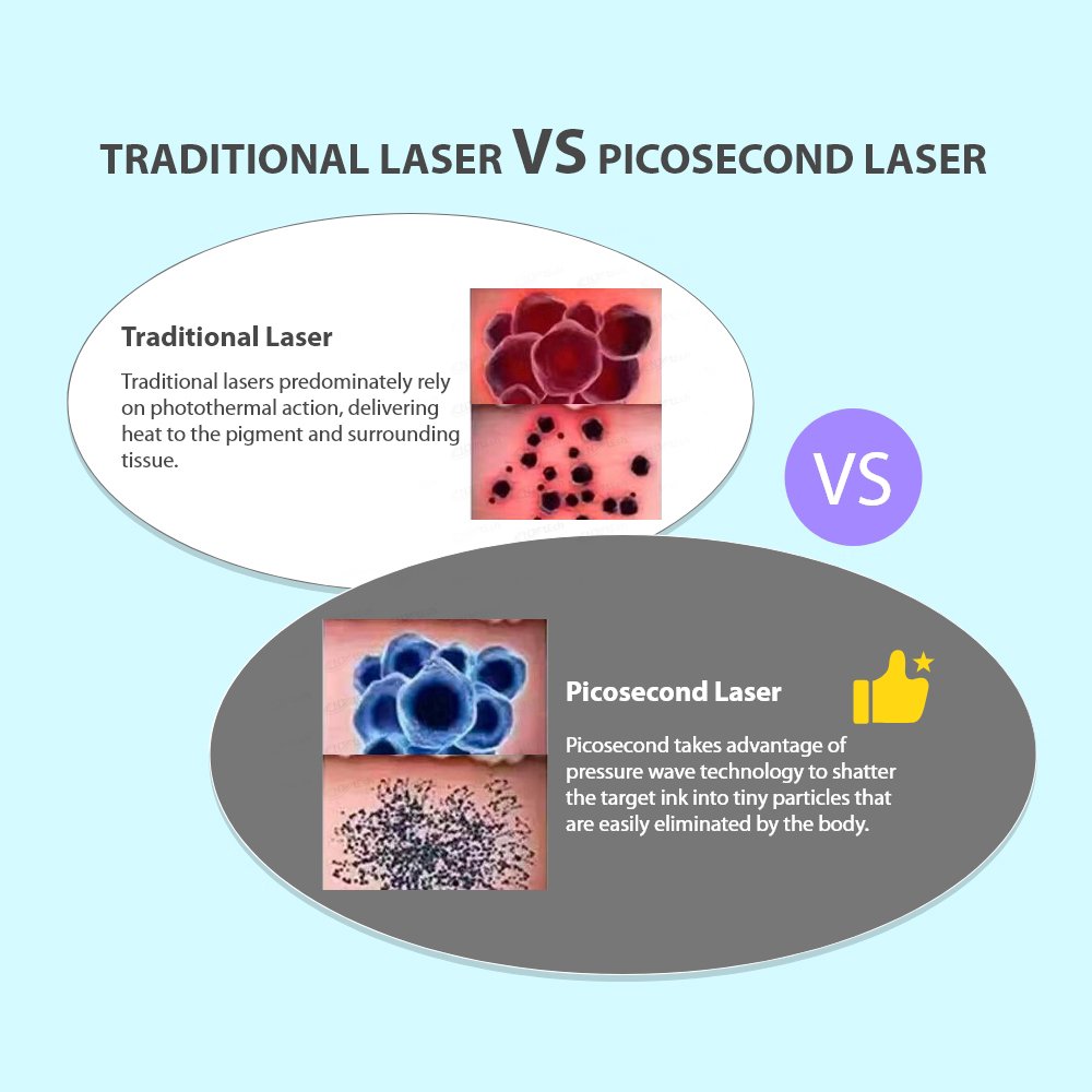 Factory direct sale most popular laser picosecond tattoo removal machine