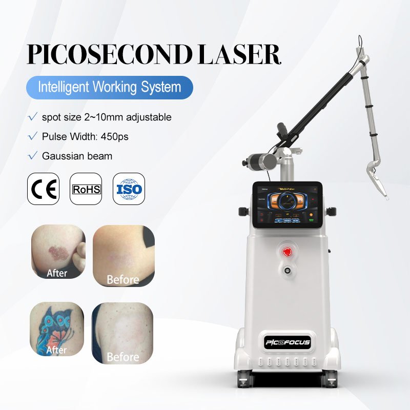 Beauty Cool System Stable Picosecond Tattoo Removal Malta Portable-Q-Switch-Nd-Yag-Laser-Machine
